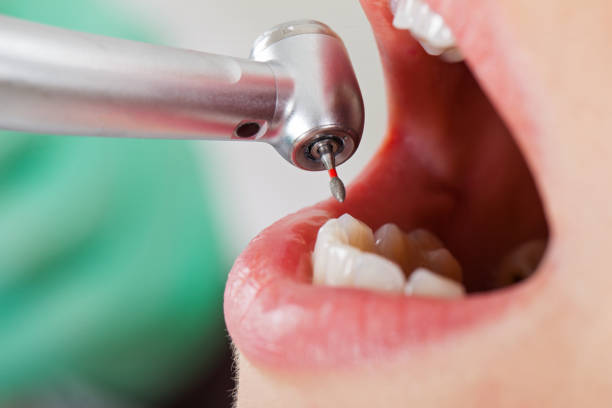 Best Emergency Treatment for Oral Infections in Mp Pendleton South, CA